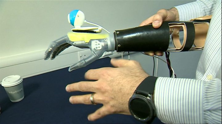 Bionic Hand ‘Sees and Grabs’ Objects Automatically