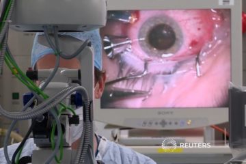 First human test of Robotic Eye Surgery hailed a success