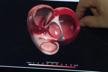 AI creates 3D ‘digital heart’ to aid patient diagnoses