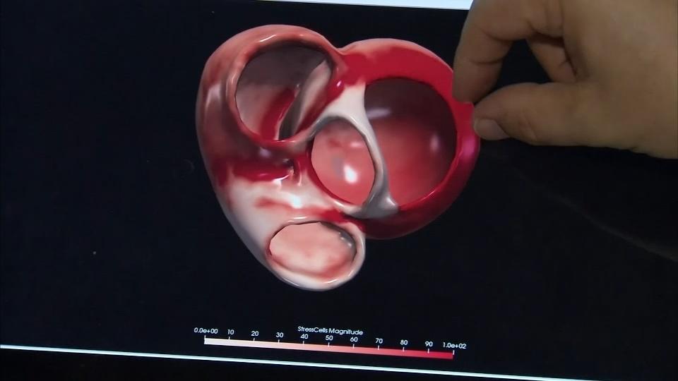 AI creates 3D ‘digital heart’ to aid patient diagnoses