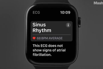 Apple’s Health-Centric Watch Series 4 can call for help if It Senses you fall