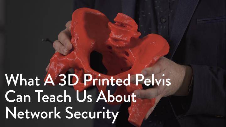 What a 3D Printed Pelvis can teach us about Network Security