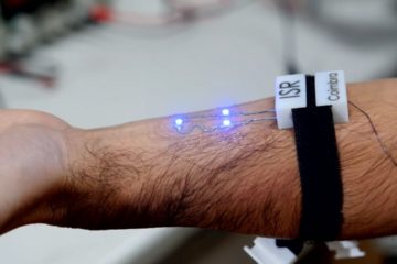 An Electronic tattoo may cure what ails you