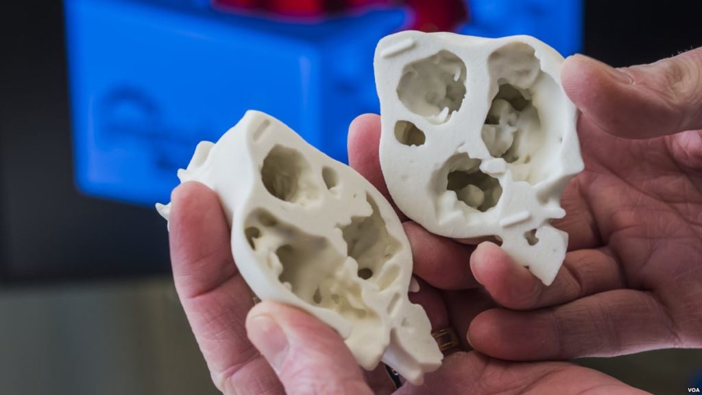 3D Printed Hearts allow Surgeons to practice before an Operation