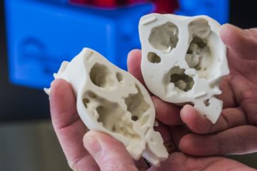 3D Printed Hearts allow Surgeons to practice before an Operation