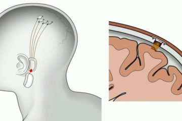 Chip allowing Brain-Computer Communication to come ‘before the end of next year’